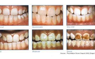Fluoride Levels in Drinking Water Lowered Due to Health Risks
